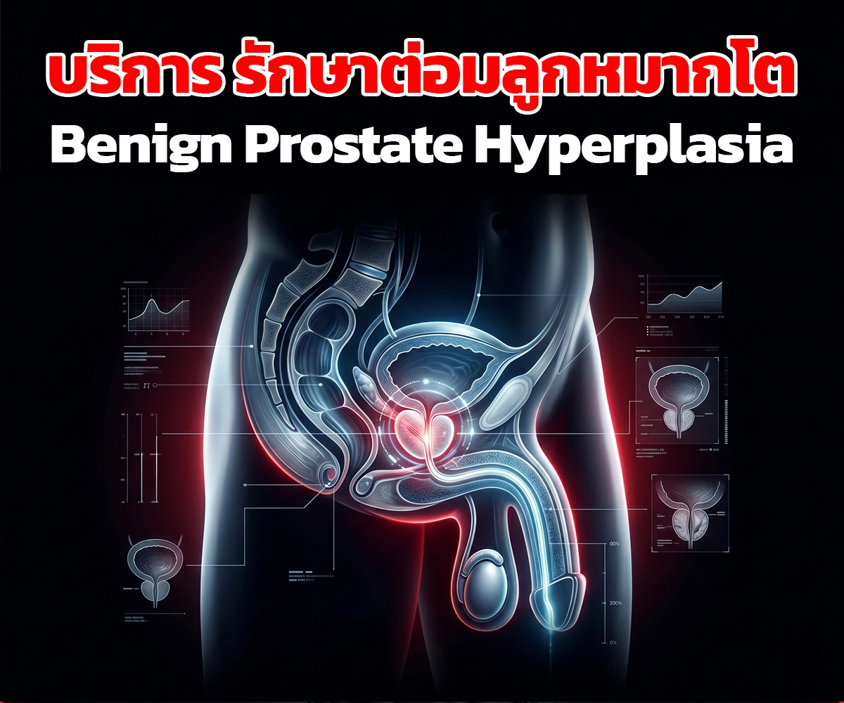 รักษาต่อมลูกหมากโต