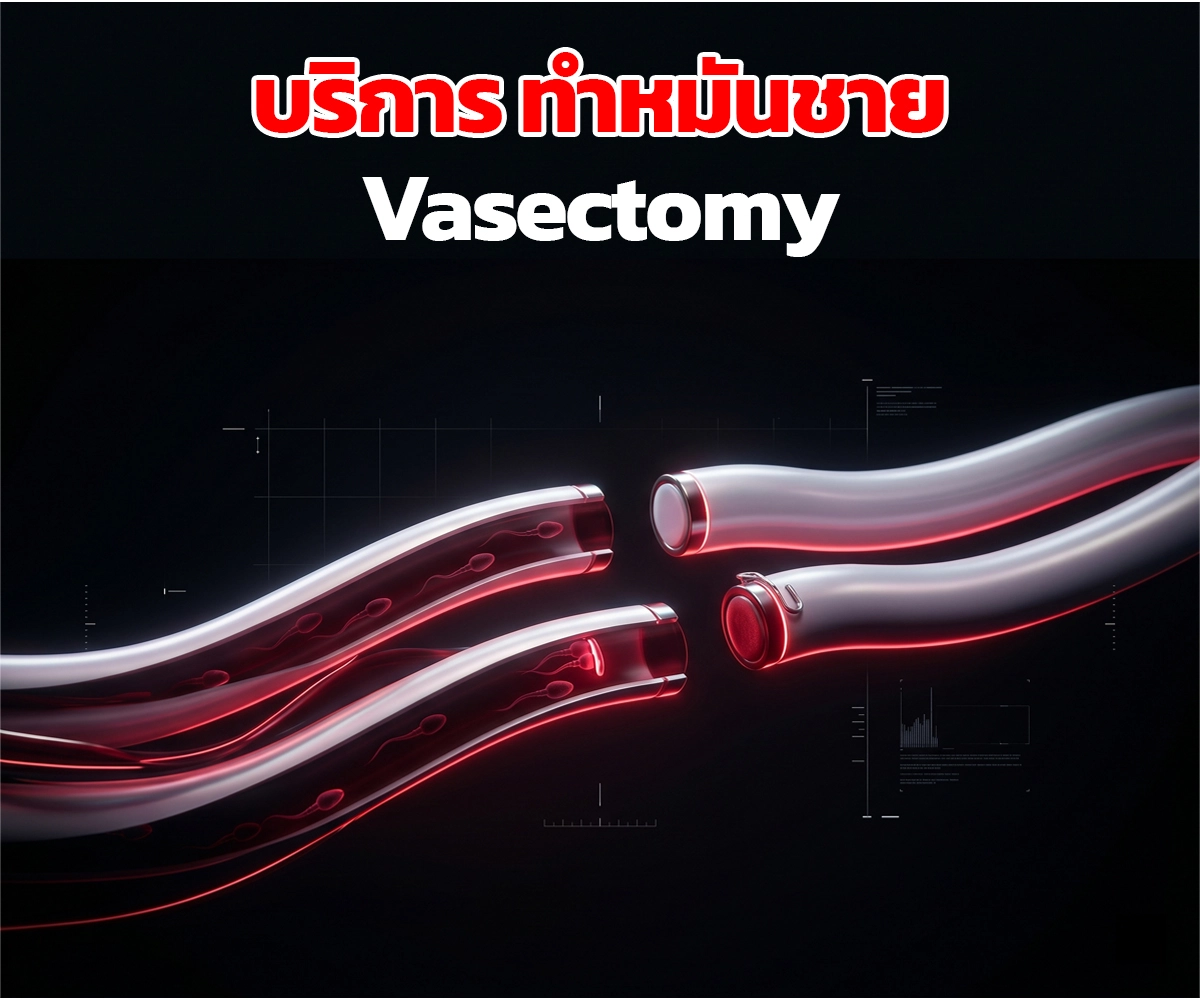 ทำหมันชาย