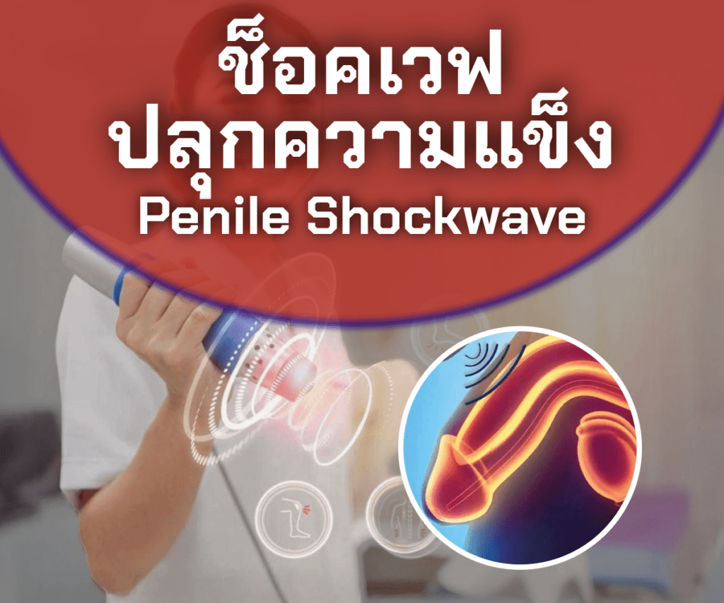 ช็อคเวฟ