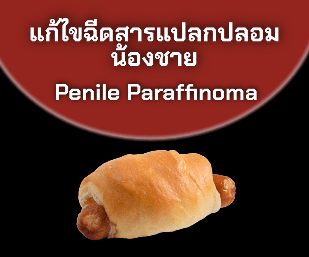 เลาะสารเหลว